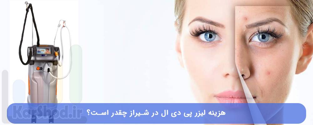 هزینه لیزر پی دی ال در شیراز