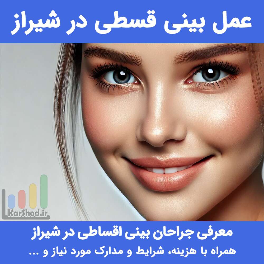 هزینه عمل بینی اقساط در شیراز
