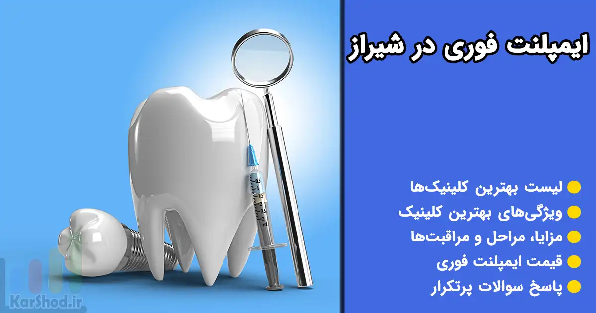 ایمپلنت فوری در شیراز
