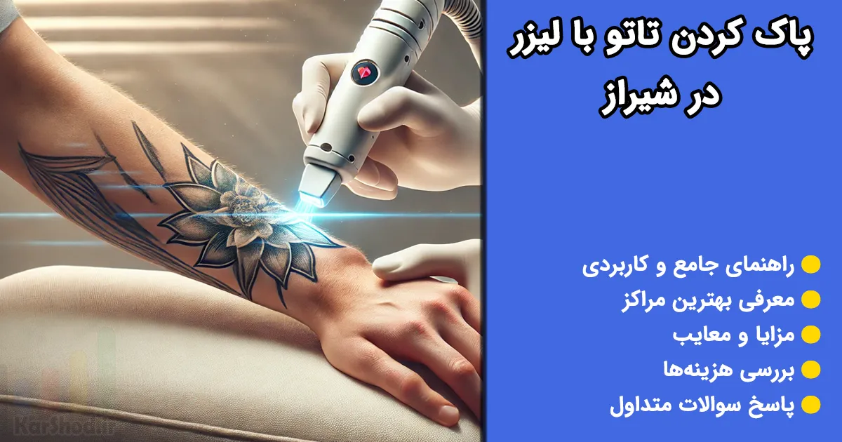 پاک کردن تتو در شیراز پاک کردن تتو در شیراز