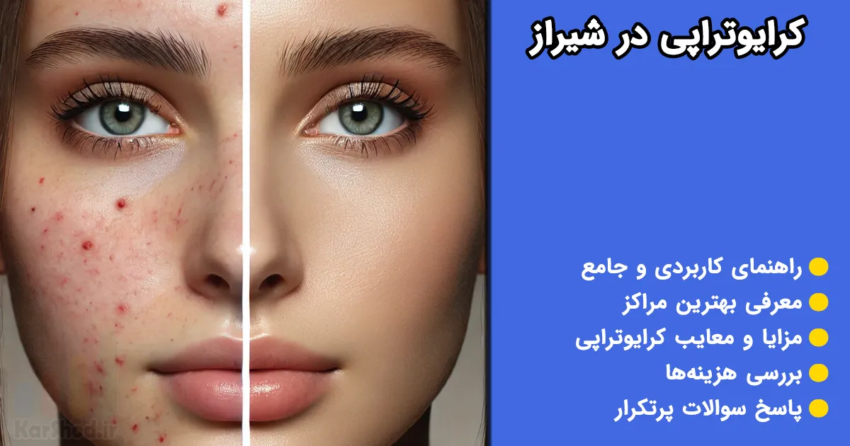 کرایوتراپی در شیراز