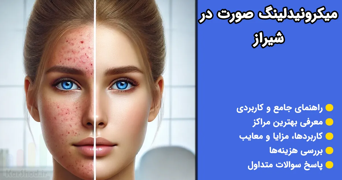 میکرونیدلینگ در شیراز