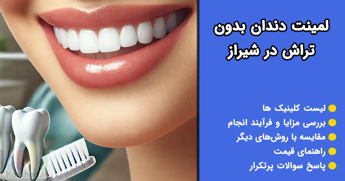 لمینت دندان بدون تراش در شیراز