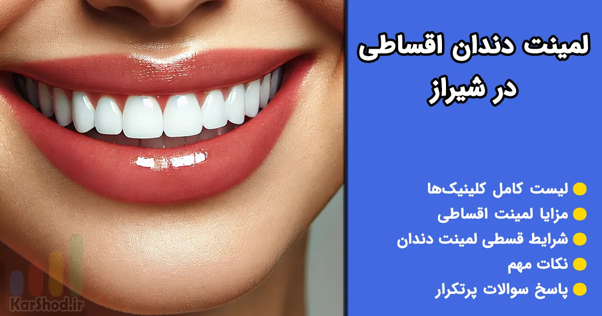لمینت دندان اقساطی در شیراز