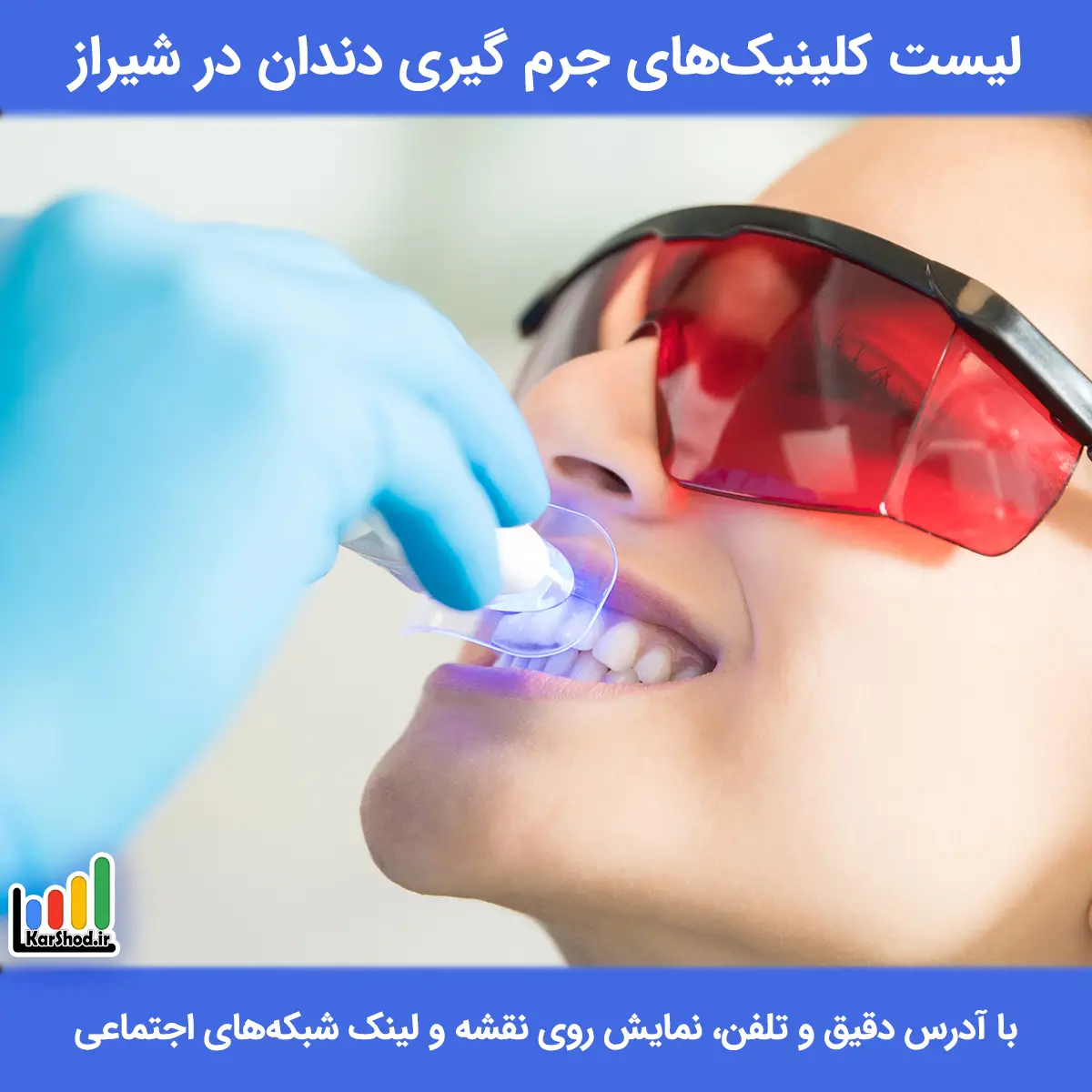 لیست کلینیک های جرم گیری دندان در شیراز همراه با آدرس و تلفن جرم گیری دندان در شیراز