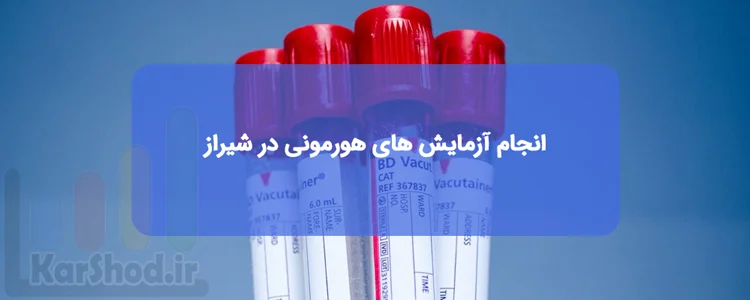 آزمایش های هورمونی در شیراز