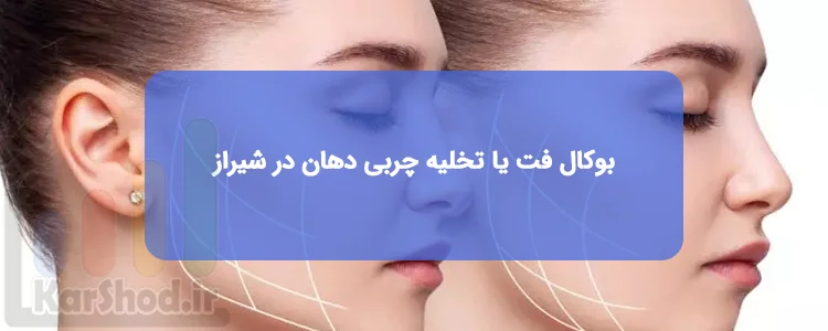 جراحی بوکال فت یا تخلیه چربی دهان در شیراز جراحی بوکال فت یا تخلیه چربی دهان در شیراز