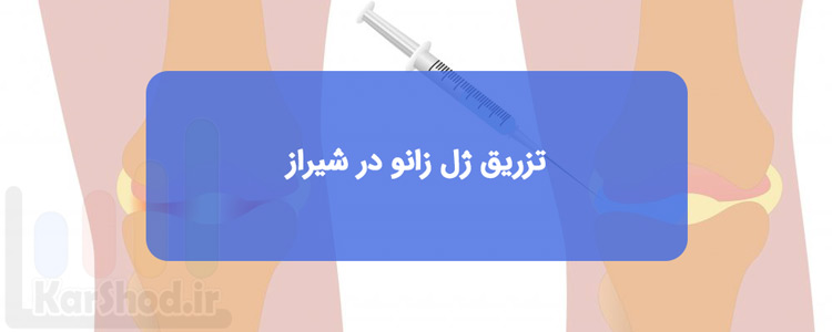 تزریق ژل زانو در شیراز تزریق ژل زانو در شیراز