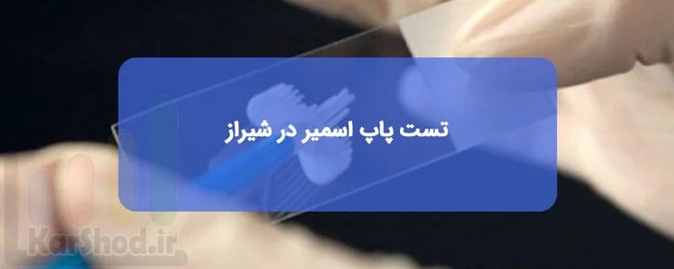 تست پاپ اسمیر در شیراز