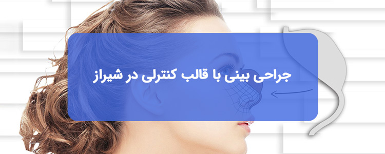 جراحی بینی با قالب کنترلی در شیراز جراحی بینی با قالب کنترلی در شیراز