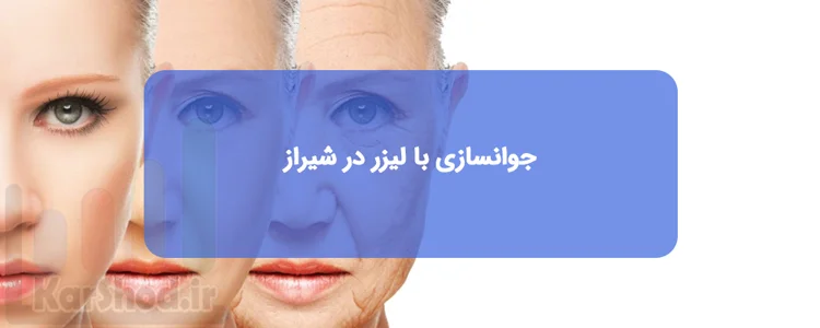 جوانسازی پوست با لیزر در شیراز جوانسازی پوست با لیزر در شیراز