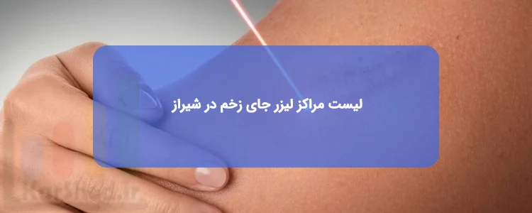 لیزر جای زخم در شیراز لیزر جای زخم در شیراز
