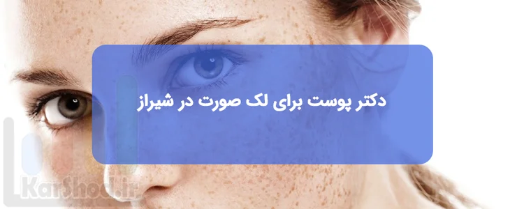 بهترین دکتر پوست برای لک صورت در شیراز بهترین دکتر پوست برای لک صورت در شیراز