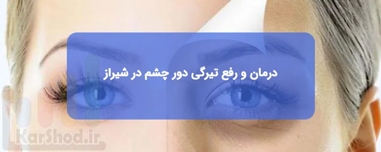درمان و رفع تیرگی دور چشم در شیراز