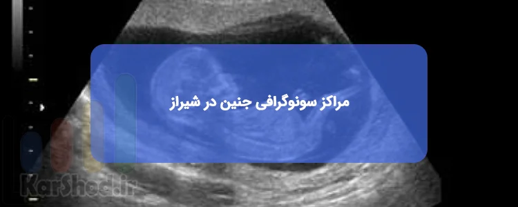 سونوگرافی جنین در شیراز سونوگرافی جنین در شیراز