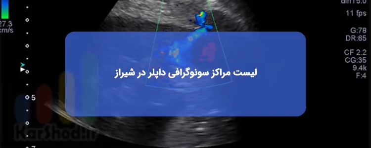سونوگرافی رنگی یا داپلر در شیراز سونوگرافی رنگی یا داپلر در شیراز