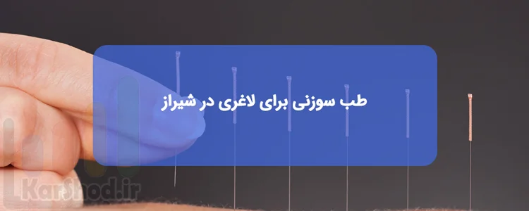 طب سوزنی برای لاغری در شیراز | لیست پزشکان، آدرس و تلفن طب سوزنی برای لاغری در شیراز | لیست پزشکان، آدرس و تلفن