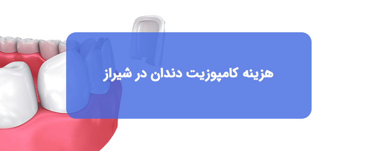 هزینه کامپوزیت دندان در شیراز هزینه کامپوزیت دندان در شیراز