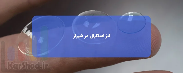 لنز اسکلرال در شیراز لنز اسکلرال در شیراز