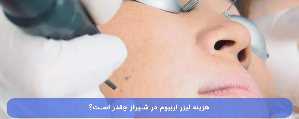 هزینه لیزر اربیوم در شیراز