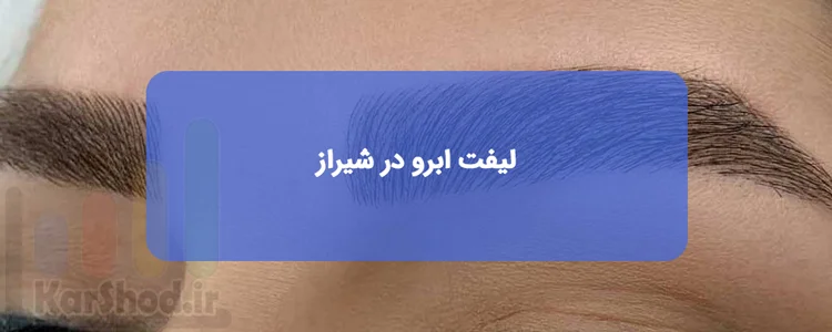 لیفت ابرو در شیراز لیفت ابرو در شیراز