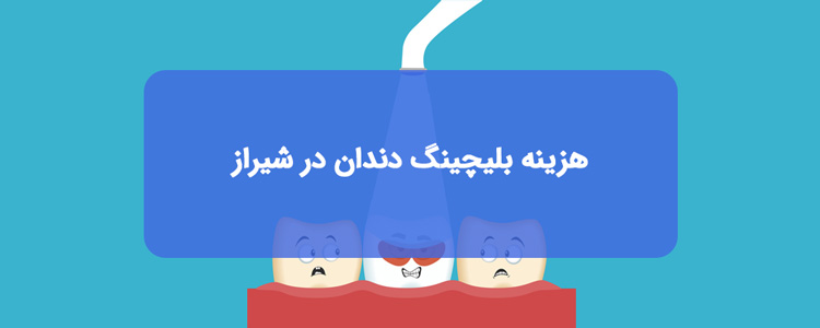 قیمت و هزینه بلیچینگ دندان در شیراز قیمت و هزینه بلیچینگ دندان در شیراز