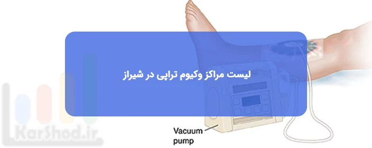 وکیوم تراپی در شیراز وکیوم تراپی در شیراز