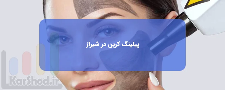 پیلینگ کربن در شیراز پیلینگ کربن در شیراز