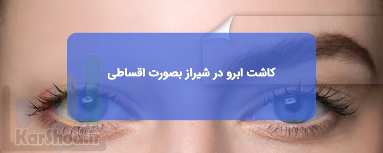 کاشت ابرو قسطی در شیراز کاشت ابرو قسطی در شیراز