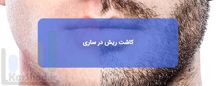 کاشت ریش در ساری کاشت ریش در ساری