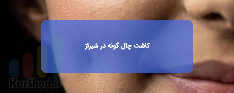 کاشت چال گونه در شیراز کاشت چال گونه در شیراز