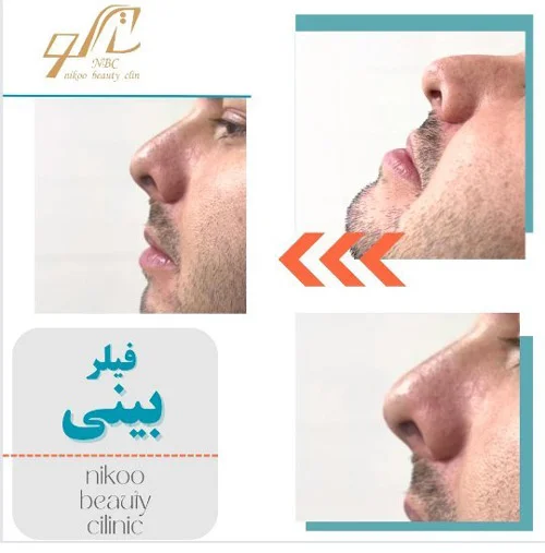 الصور عيادة نیکو شیراز الصور عيادة نیکو شیراز