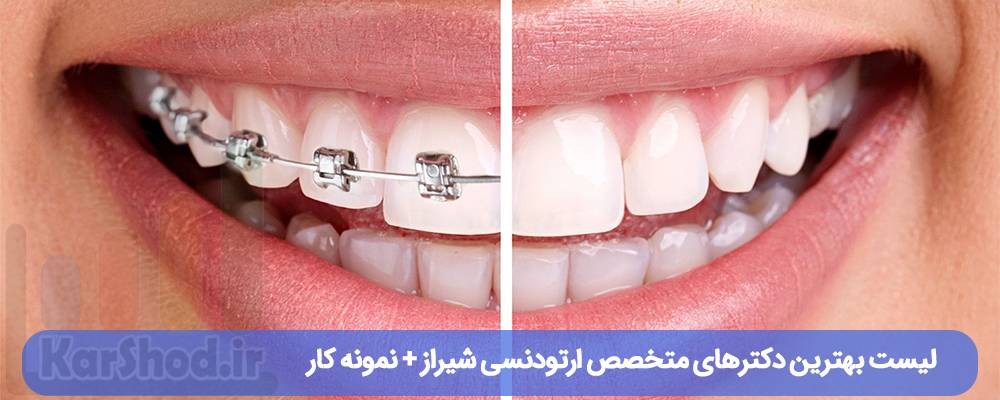 لیست بهترین دکترهای ارتودنسی شیراز