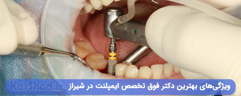 بهترین دکتر فوق تخصص ایمپلنت در شیراز