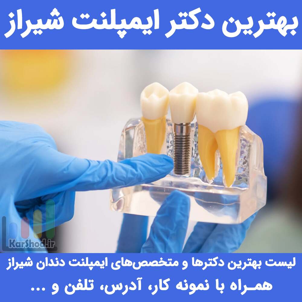 بهترین دکتر ایمپلنت شیراز