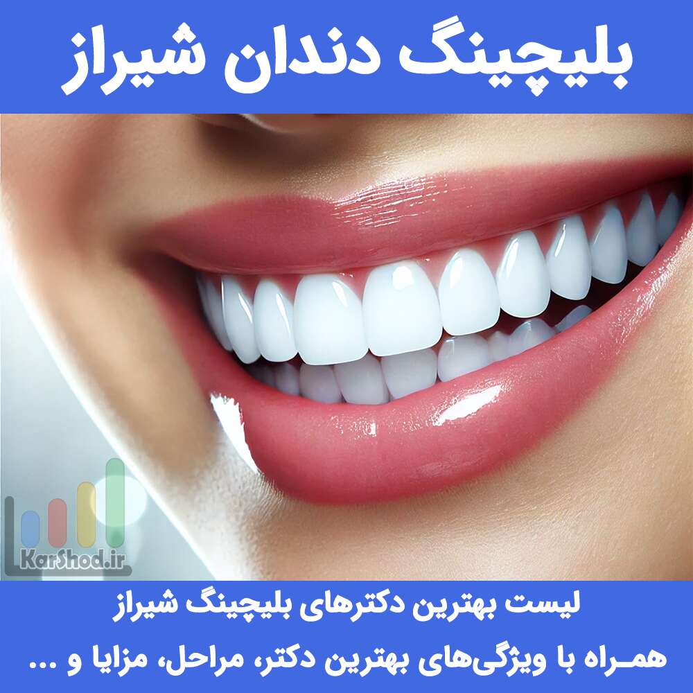 بلیچینگ دندان شیراز