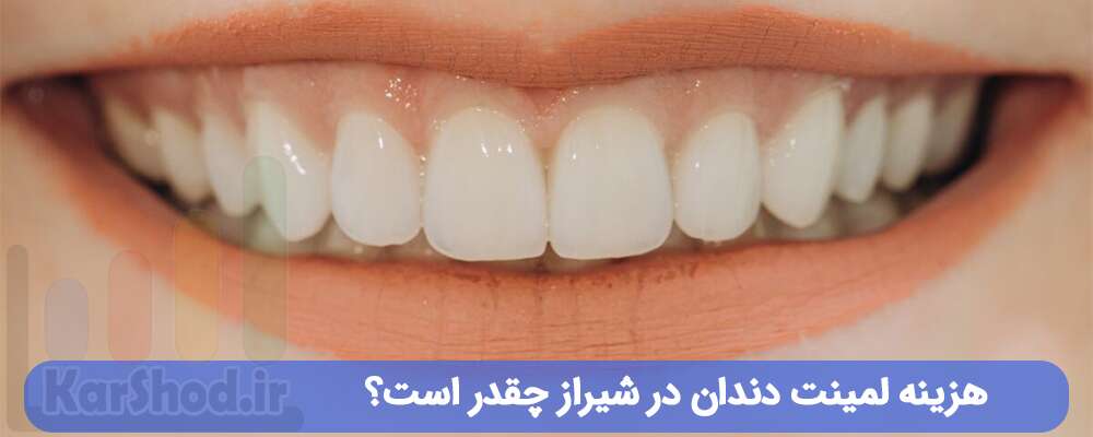 هزینه لمینت دندان در شیراز چقدر است؟