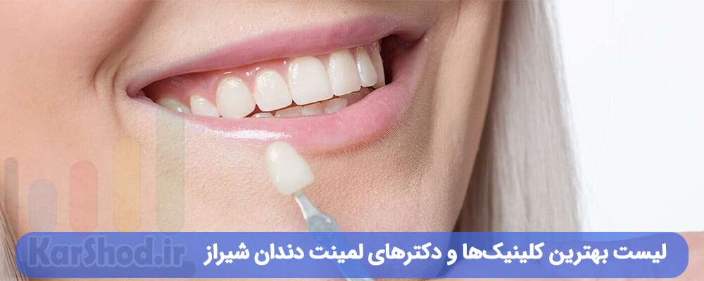 لیست بهترین کلینیک‌ها و دکترهای لمینت دندان شیراز با نمونه کار