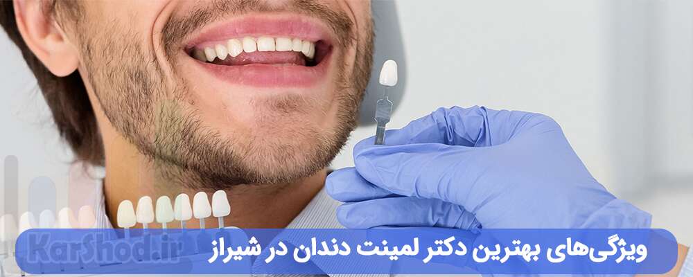 ویژگی‌های بهترین دکتر لمینت در شیراز