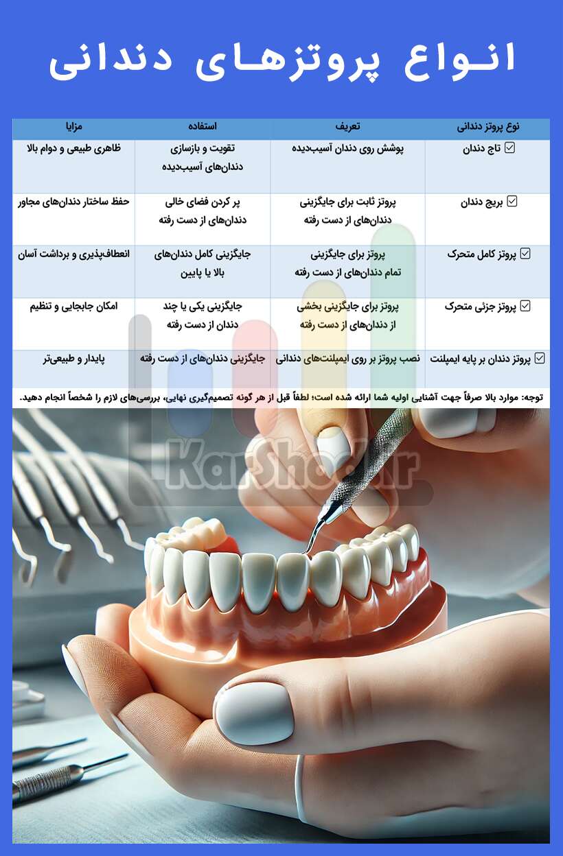 انواع پروتزهای دندانی