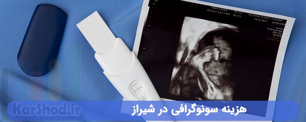 هزینه سونوگرافی در شیراز