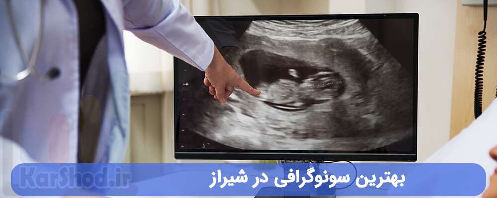 بهترین سونوگرافی در شیراز