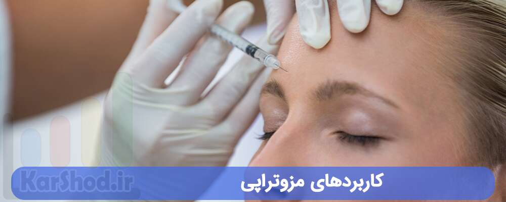 کاربردهای مزوتراپی در شیراز کاربردهای مزوتراپی در شیراز