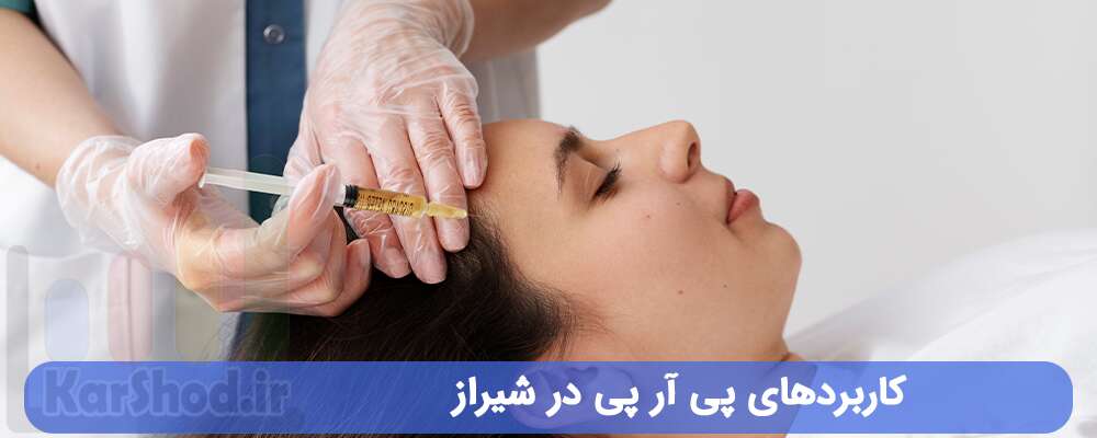 کاربردهای پی آر پی در شیراز کاربردهای پی آر پی در شیراز