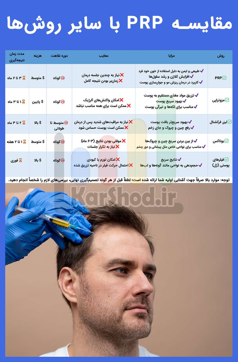 مقایسه پی آر پی با سایر روشها در شیراز مقایسه پی آر پی با سایر روشها در شیراز