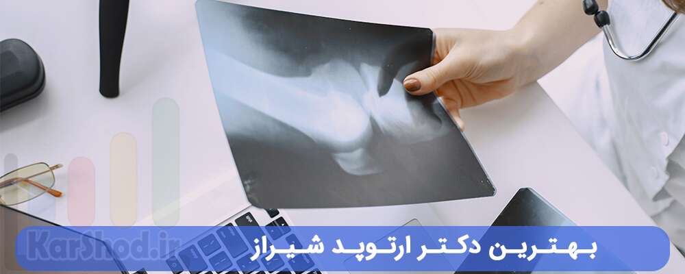 بهترین دکتر ارتوپد شیراز