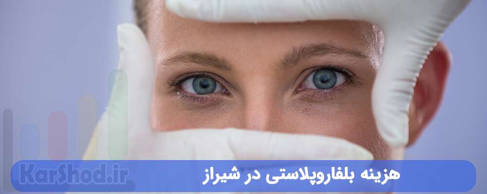 هزینه بلفاروپلاستی در شیراز