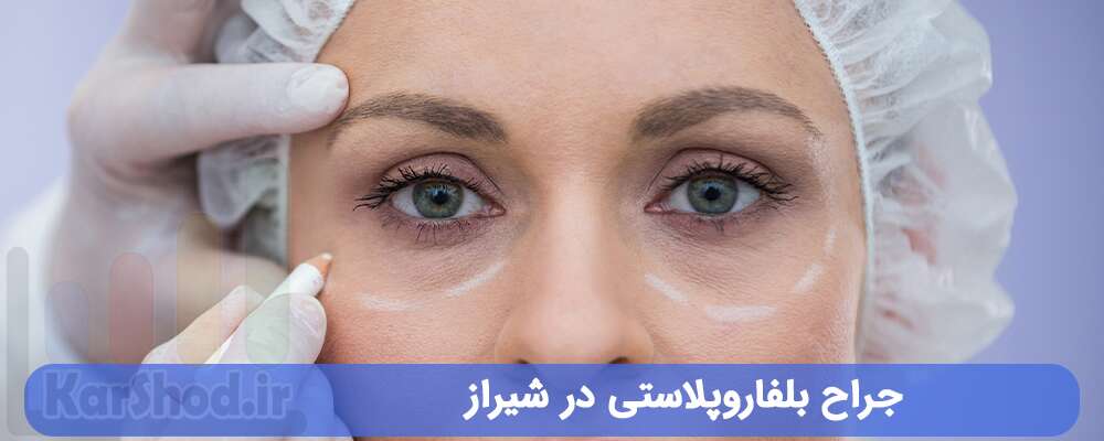 جراح بلفاروپلاستی در شیراز