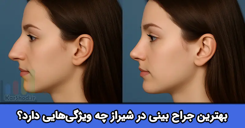 بهترین جراح بینی در شیراز