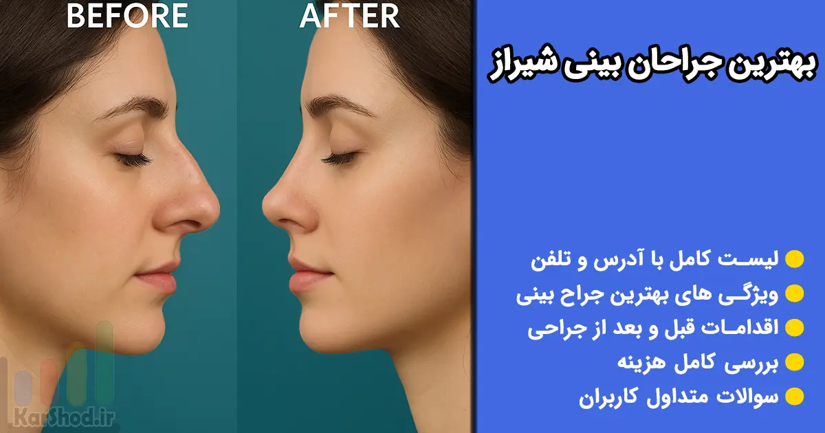 جراحی بینی در شیراز